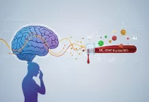 Biomarcadores para doenças neurodegenerativas