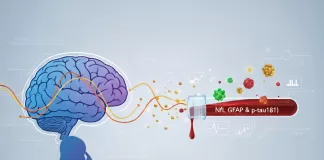 Biomarcadores para doenças neurodegenerativas