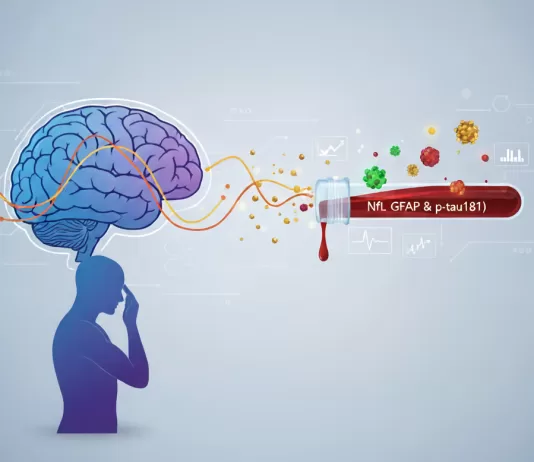 Biomarcadores para doenças neurodegenerativas